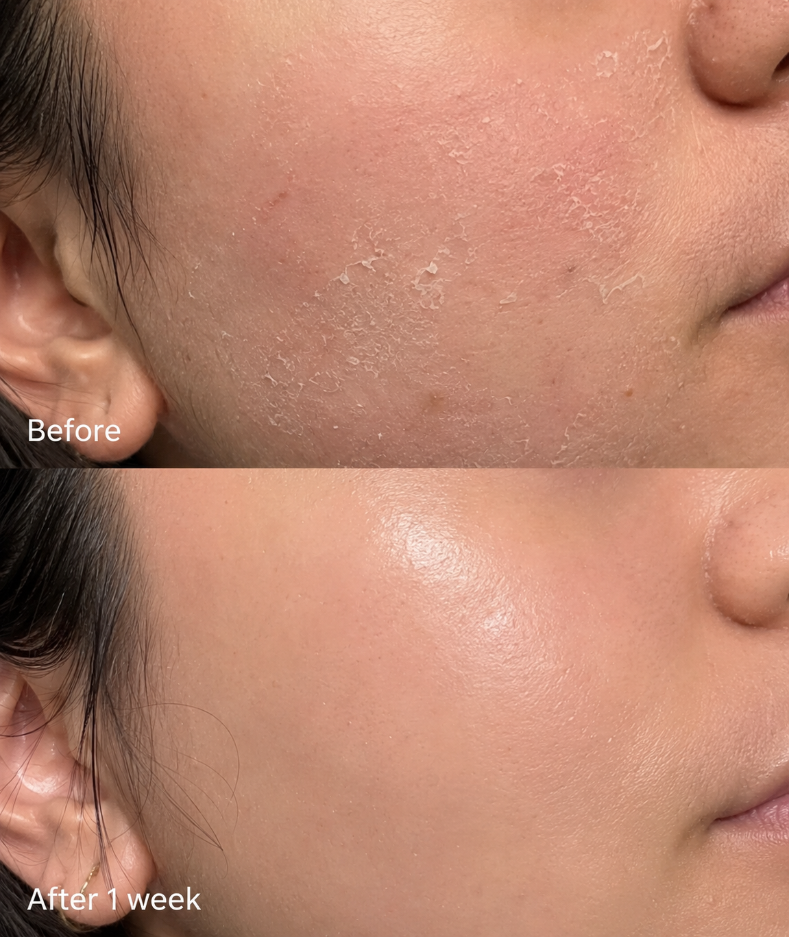 CALM & CO. Blue Recovery Cream — Barrier & Blemish Repair (60g)